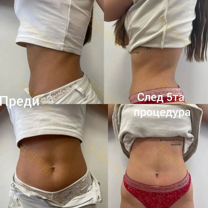 EMS Body Sculpt Slimming Machine NEO Rf Body Sculpting Electromagnetic Muscle stimulate Fat Burning Weight Lose Equipment